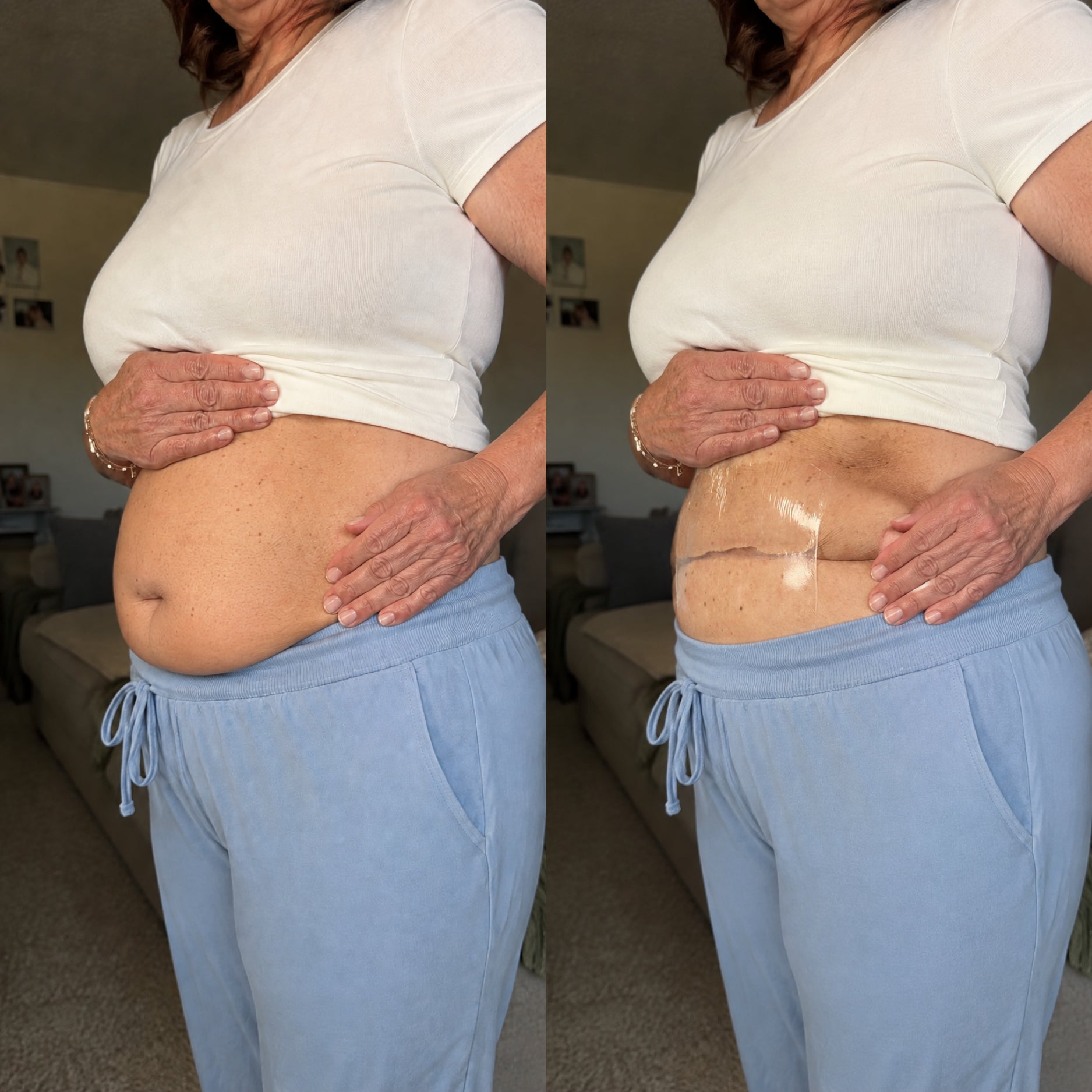 Before and after applying LiftForm